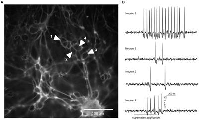 Fecal supernatants from dogs with idiopathic epilepsy activate enteric neurons